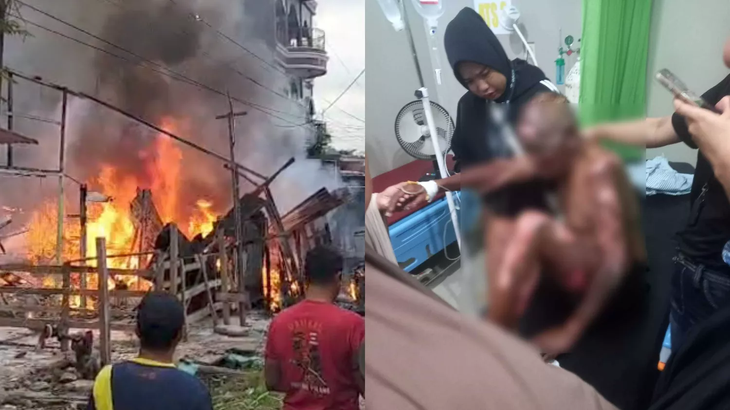 Dua Rumah Ludes Terbakar di Kendari, Satu Korban Luka Bakar