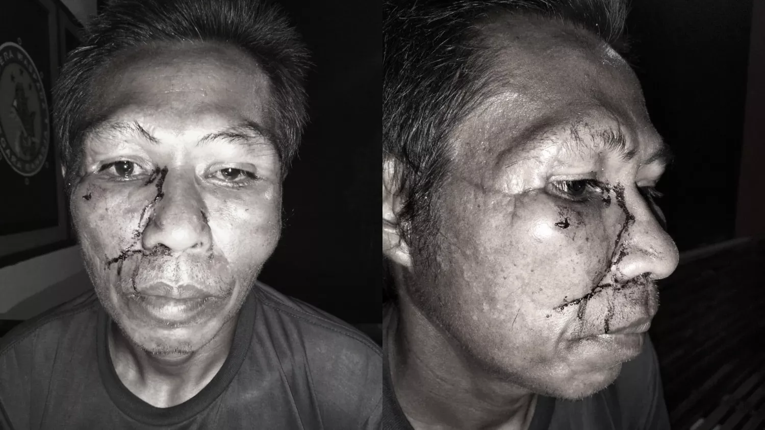 Petani di Muna Barat Diduga Dianiaya Ketua BPD, Sempat Diserang dengan Parang